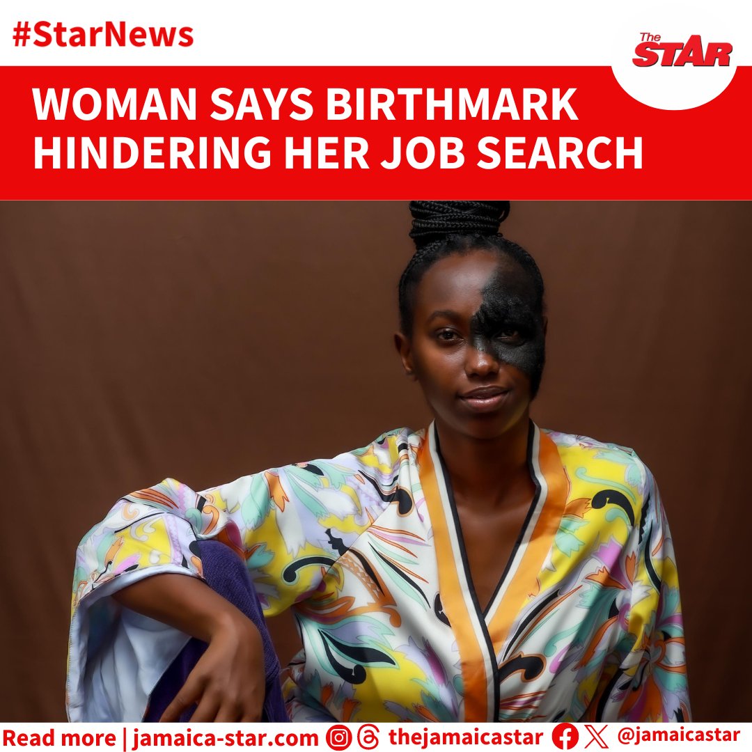 #StarNews: A unique birthmark is hampering 23-year-old Westmoreland native Roxanne Spiller from securing employment as prospective employers are seemingly turned off by the feature which covers almost half of her face.

READ MORE: tinyurl.com/mrxb6u7r