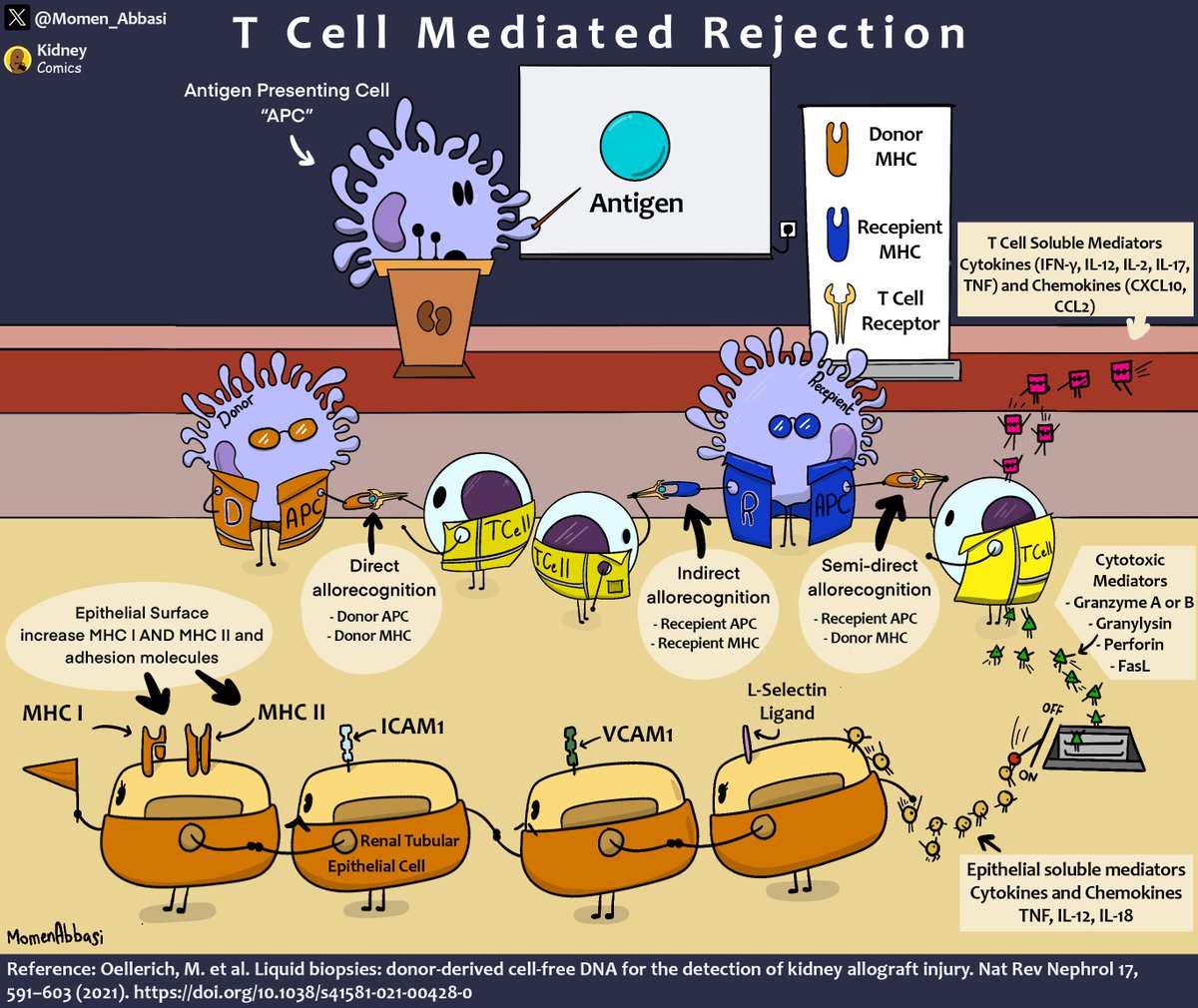 #Kidney Comics by @Momen_Abbasi: T Cell Mediated Rejection renalfellow.org/2024/05/03/kid… #FOAMed #MedEd #KidneyTransplant