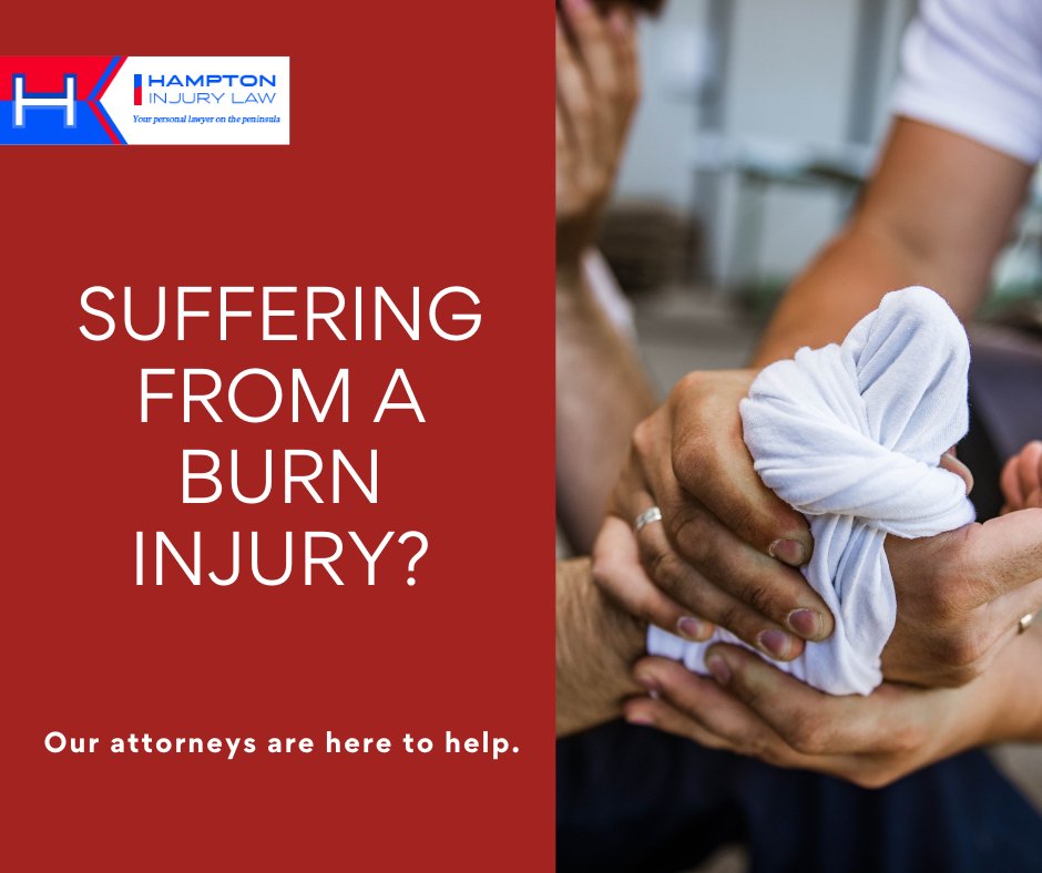 We have the resources and experience to uncover the cause of your burn injury and hold those responsible for causing your injuries accountable for the expenses and losses you experienced. Contact us today. 
#burninjury

bit.ly/2omzBiE