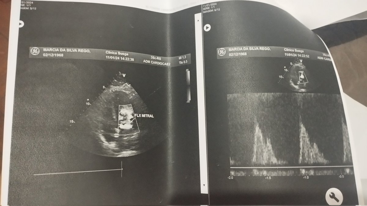 ccelliz's tweet photo. É uma cirurgia perigosa/arriscada e não  optamos pelo SUS, já que a tomografia pede-se por 6 meses de aguardo e o cateterismo 3 meses ou mais, sem previsão. No entanto, ela não pode esperar por muito tempo, já que corre o risco de ter um infarto a qualquer momento. https://t.co/RwULgEyo2W