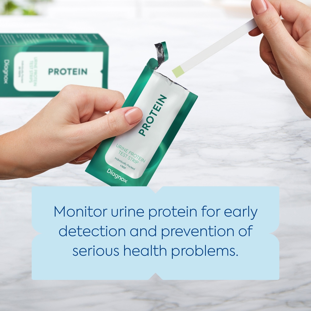 DiagnoxHealth's tweet photo. Protein in urine, or proteinuria, can be a sign of preeclampsia, a condition that may pose risks to both you and your baby if left untreated. #pregnancyjourney #preeclampsia #preeclampsiaawareness #pregnancylife

Learn more at: https://t.co/BUqYubHdTb https://t.co/hLVChIlus9