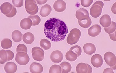 Every time Taylor says “you cinephile” I hear “eosinophil” like ok stem queen 🩸<a href="/taylornation13/">Taylor Nation</a> <a href="/taylorswift13/">Taylor Swift</a> #TSTTPD