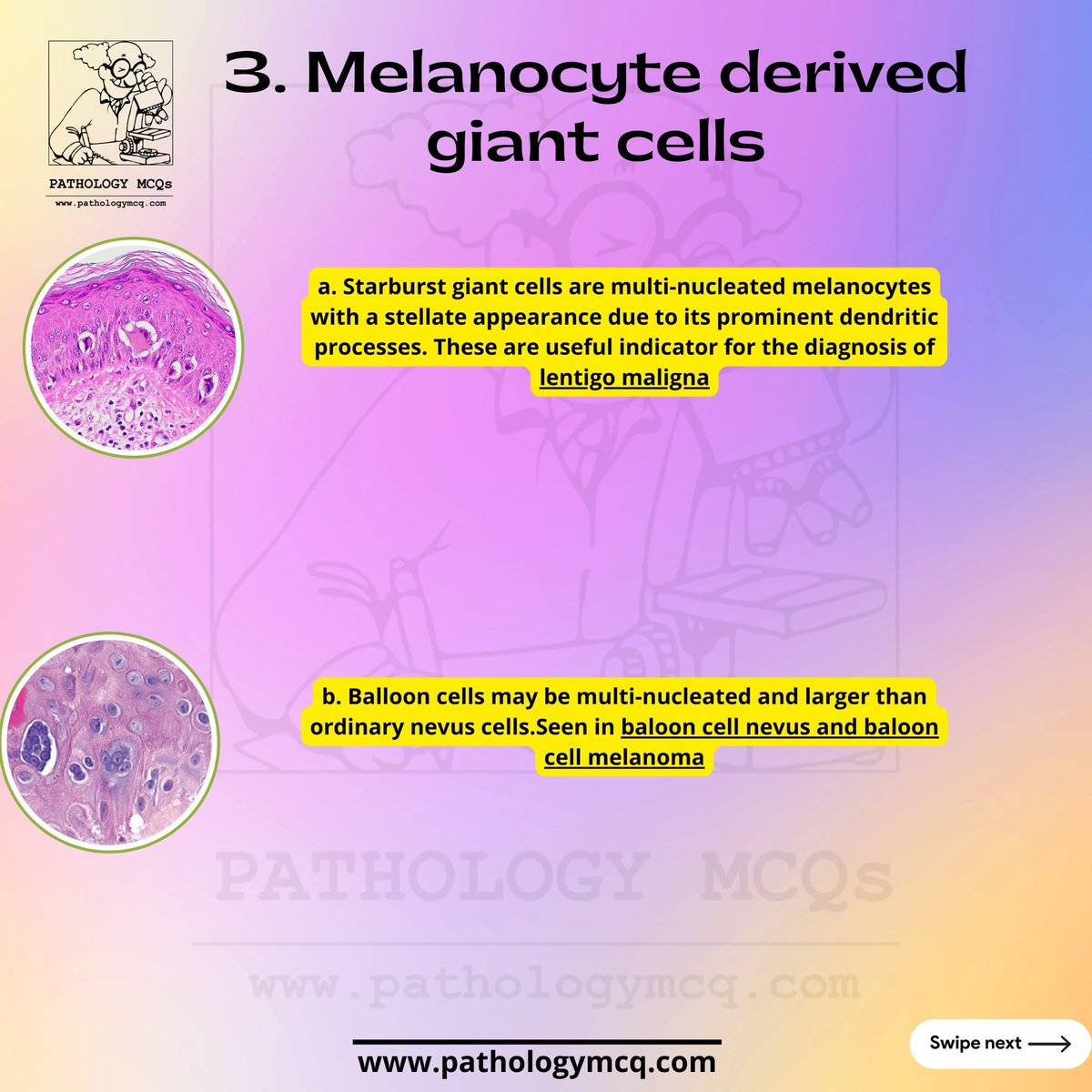 Commonly encountered giant cells in Histopathology. Do comment any more of them. #giantcells #histopathology #giantcells #pathology #pathologistsassistant #pathologyresidents