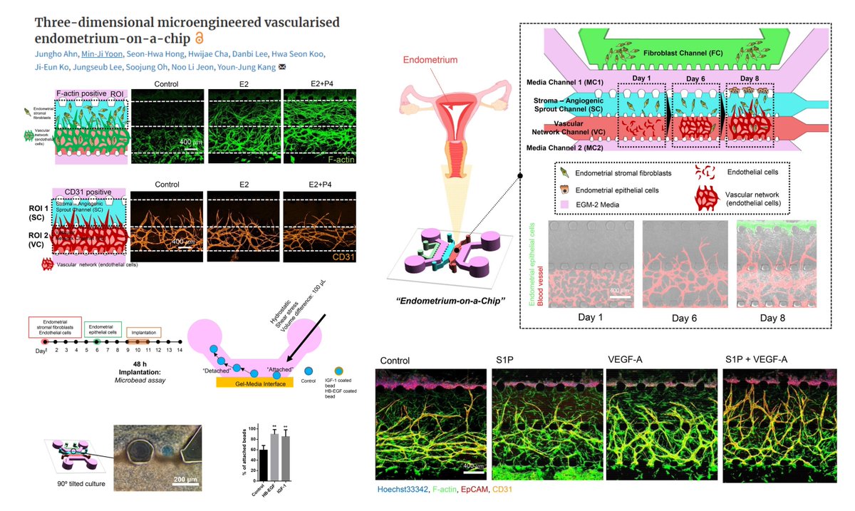 HaoYin20's tweet image. 3D vascularised Endometrium-on-a-chip
PDMS #Microfluidics 5-channel design

HUVEC
Endometrial epithelial cells
Endometrial stromal fibroblasts

Modeling some aspects of proliferative-secretory phases of #MenstrualCycle

Sex steroid-induced 
Epithelial thickening✅
Angiogenesis❎…