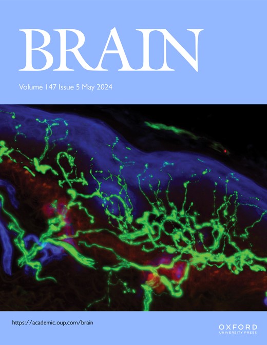New issue of Brain now online! academic.oup.com/brain/issue/14…