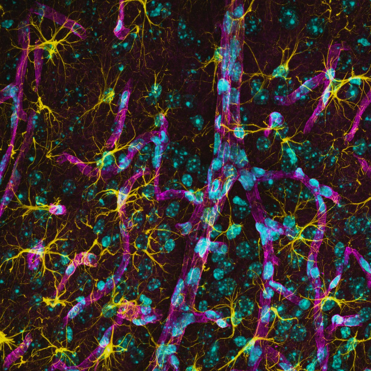 Toby (@toby_segasby) on Twitter photo Astrocytes et al.
GFAP, AQP4 and Hoechst
#FluorescenceFriday #Neuroscience #Astrocytes #Microscopy #Leica
<a href="/DCU_LSI/">DCU Life Sciences Institute</a> Astrocytes et al.
GFAP, AQP4 and Hoechst
#FluorescenceFriday #Neuroscience #Astrocytes #Microscopy #Leica
<a href="/DCU_LSI/">DCU Life Sciences Institute</a>