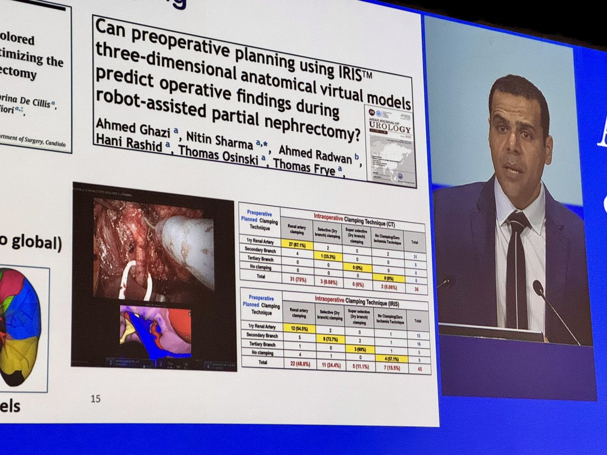 Tiago Borelli Bovo (@uroborelli) on Twitter photo 3D preoperative planning increases the use of selective clamping in partial neohrectomy <a href="/aghazimd/">Ahmed Ghazi</a> #AUA2024 3D preoperative planning increases the use of selective clamping in partial neohrectomy <a href="/aghazimd/">Ahmed Ghazi</a> #AUA2024