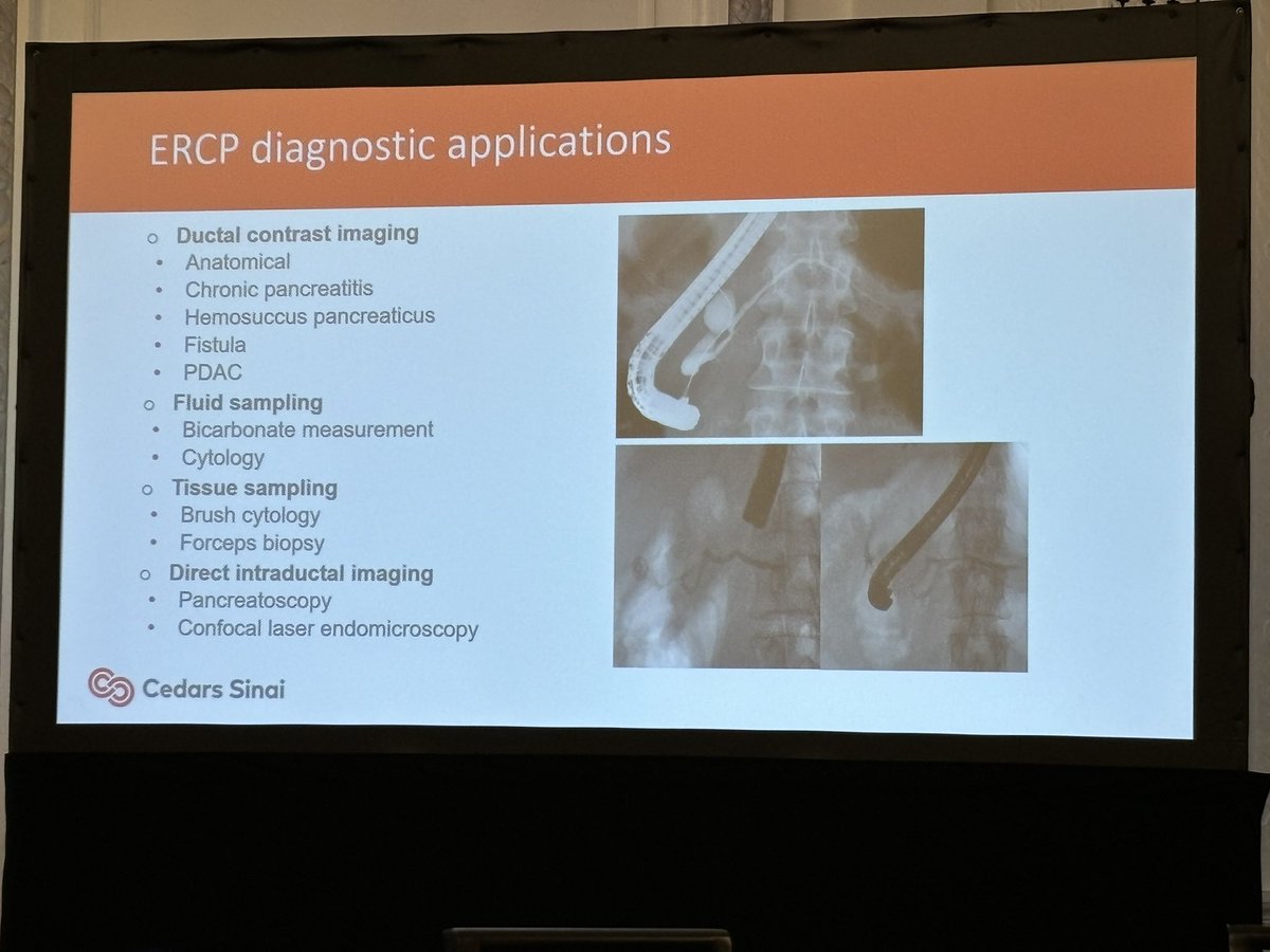 clivejmiranda's tweet photo. π What role does endoscopy have in the diagnosis and treatment of pancreatic diseases?
Dr. #SimonLo from @CedarsSinai gives us the breakdown with an excellent π£οΈ on upper endoscopy, EUS, ERCP, and so much more π
@NatPancFdn #GITwitter #PancTwitter https://t.co/TQSQRbm4ca