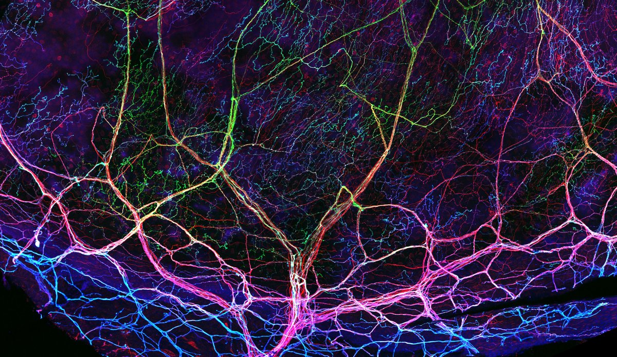 Alain Chédotal (@alainchedotal) on Twitter photo what about a nerves in the mouse cornea for #FluorescenceFriday ?
<a href="/BizzarriElena/">Elena Bizzarri</a> <a href="/InstVisionParis/">Institut de la Vision</a> what about a nerves in the mouse cornea for #FluorescenceFriday ?
<a href="/BizzarriElena/">Elena Bizzarri</a> <a href="/InstVisionParis/">Institut de la Vision</a>