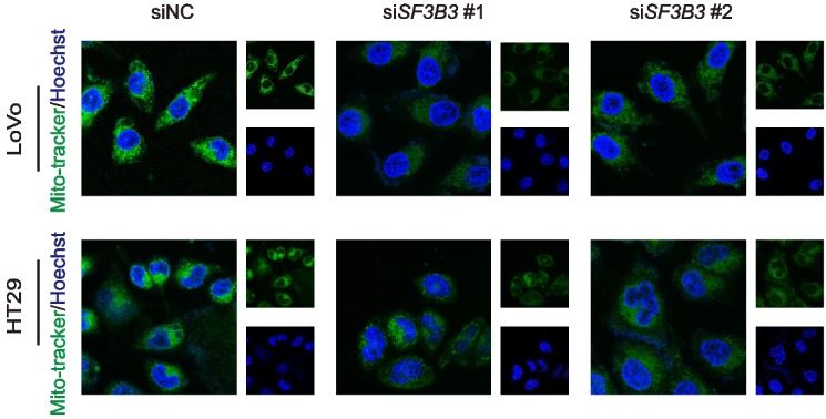 Colorectal cancer (CRC) cell xenografts, 🧫 patient-derived xenografts, patient-derived #organoids, and orthotopic #metastasis 🐭 mouse models were utilized to determine the role of SF3B3 in CRC progression and metastasis. 🔗 bit.ly/4aYYarx