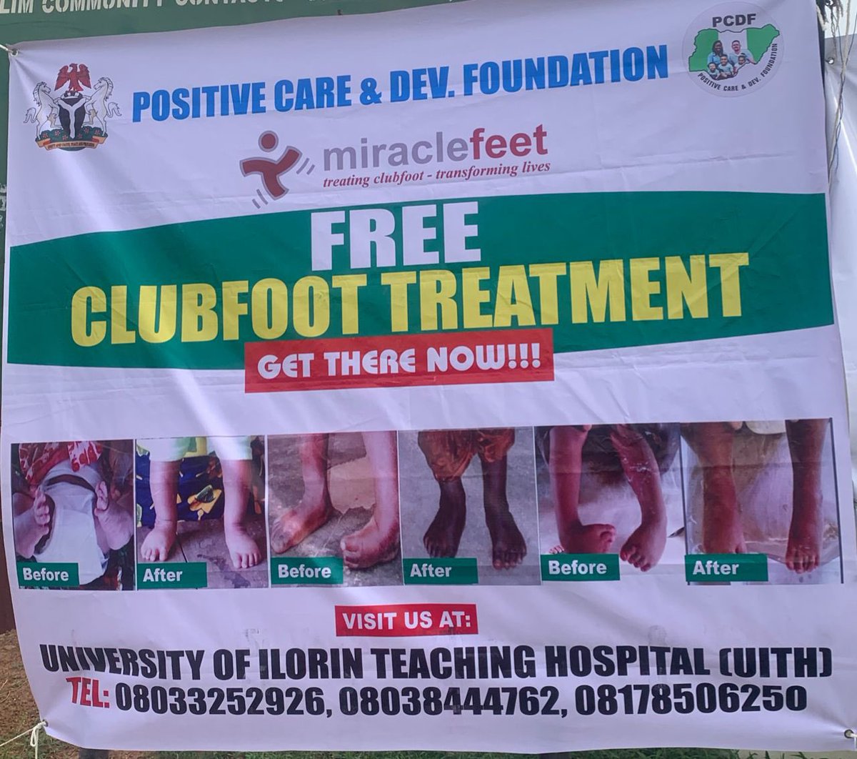 Please share, you could be saving someone from from feelings of inferiority and inability to chase their dreams🙏

Free Clubfoot Surgery 

Location: UITH, Ilorin