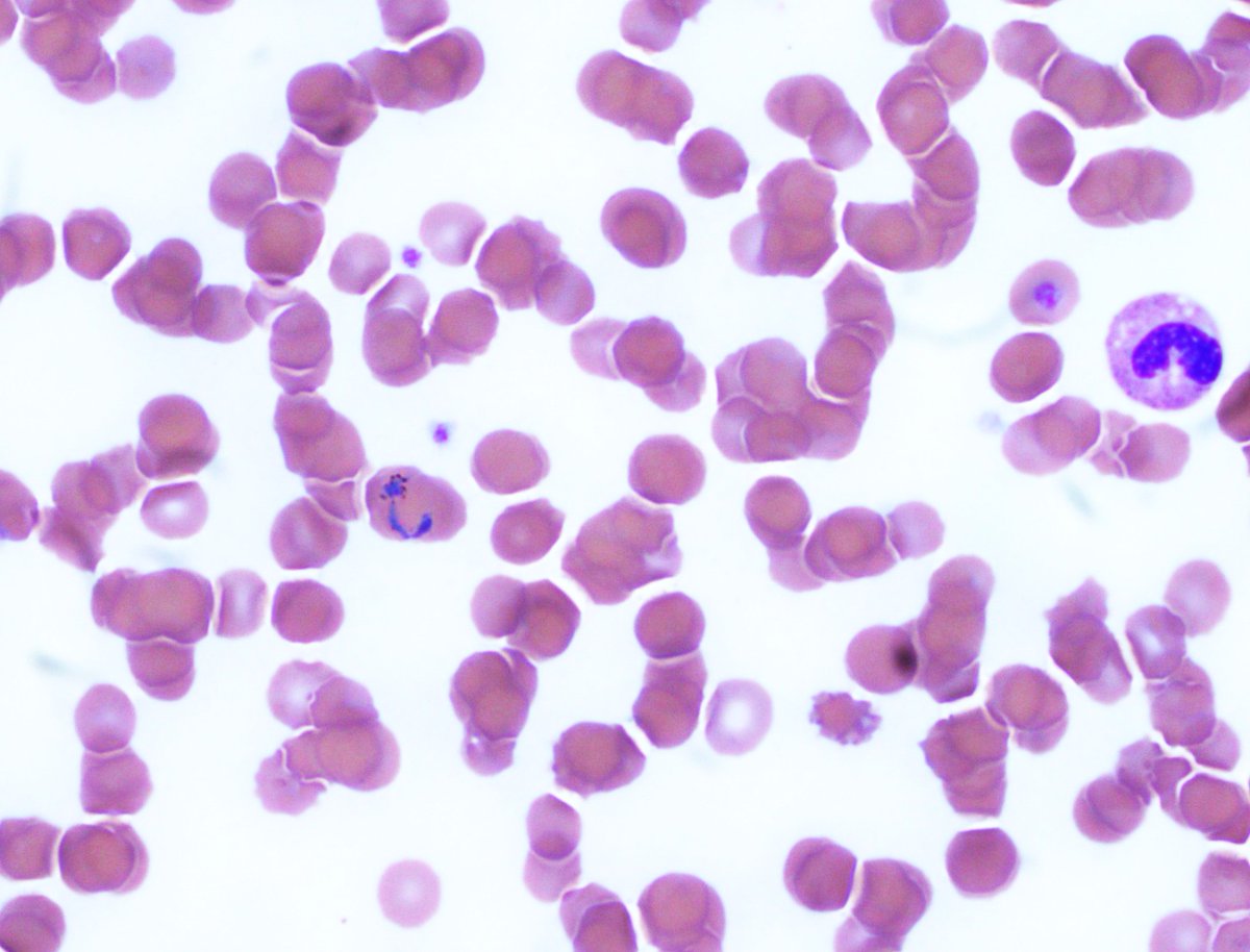 NYUGSOM Pathology Residency tweet media