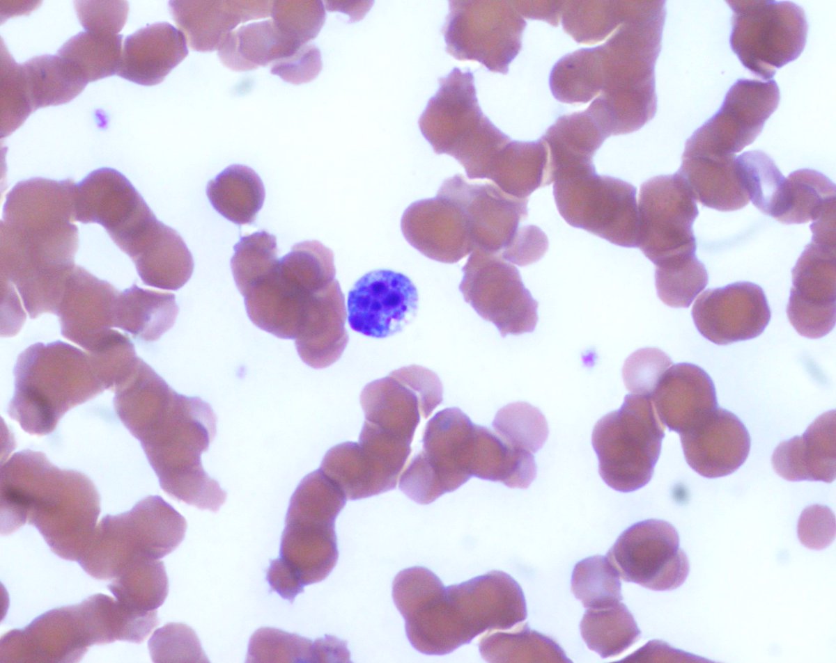 NYUGSOM Pathology Residency tweet media