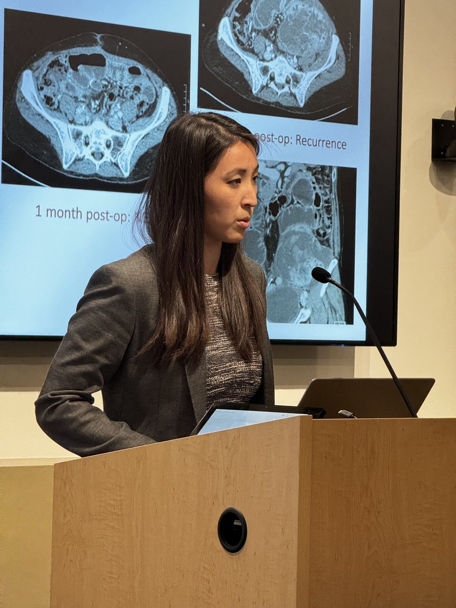 .@BeatriceSunMD’s analysis of Phase II Trial data for uterine leiomyosarcoma suggests cytoreductive surgery + HIPEC with gemcitabine and adjuvant dacarbazine is safe. Excited to see future studies evaluating efficacy in preventing peritoneal recurrence! #holman24 @DrByrneLee