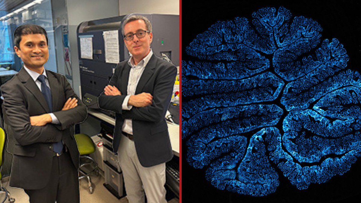 Plant-based foods and fiber supplements containing a certain type of fiber can worsen inflammatory bowel disease by causing gut inflammation, according to a preclinical study by Drs. David Artis and Mohammad Arifuzzaman (@arif_uzz_aman) of @WCMDeptofMed.

bit.ly/3JIX0ED