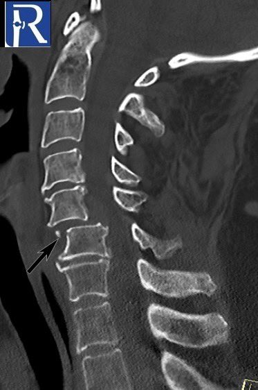 radiologybmj tweet picture