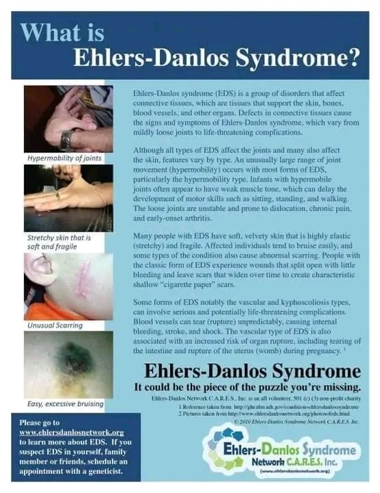 #EhlersDanlosSyndrome #EDSAwarenessMonth #EDS