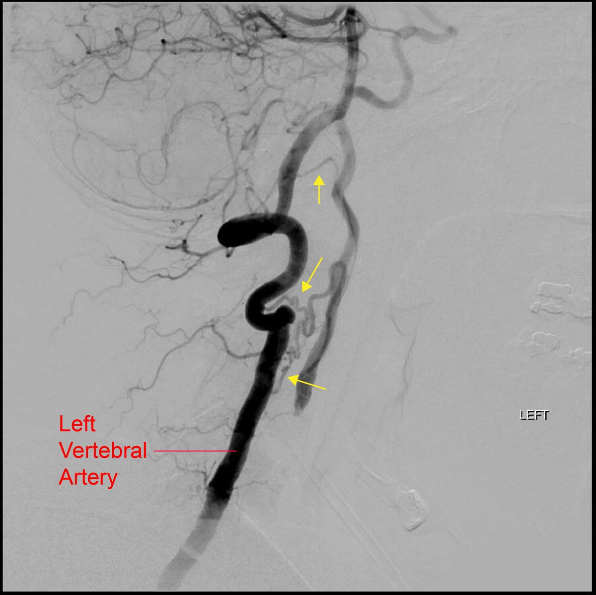 YNIS Committee tweet media