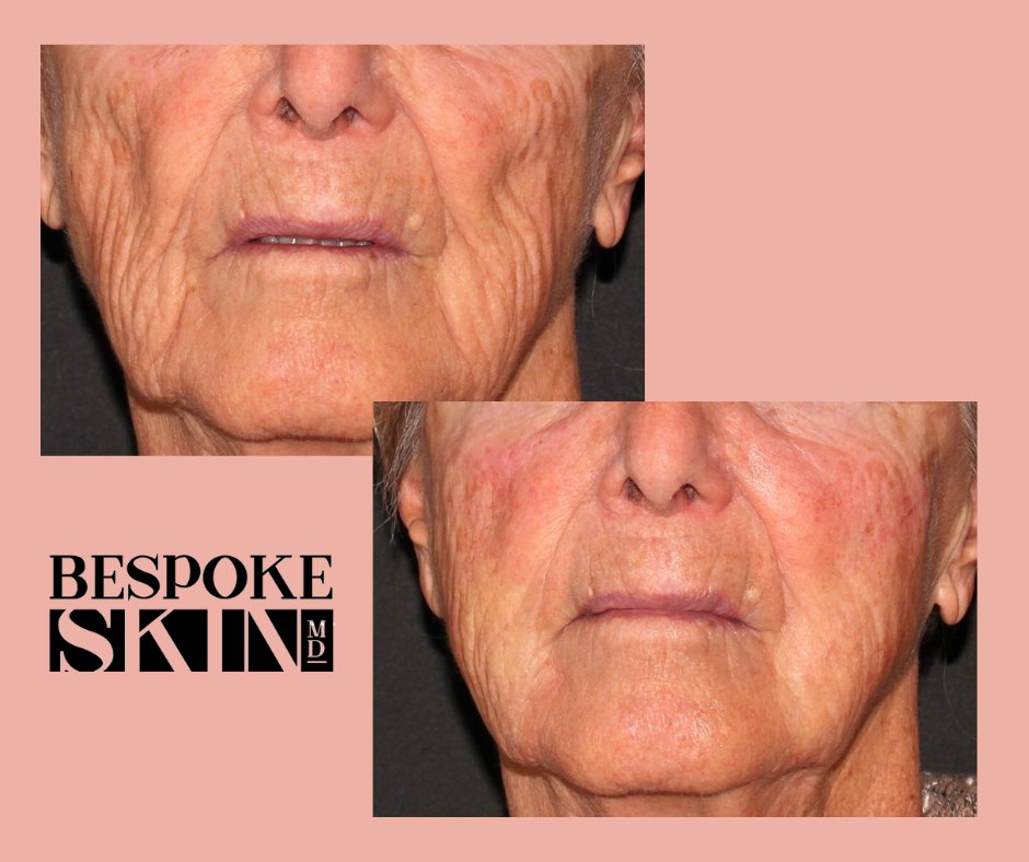 Bespoke Skin MD tweet media