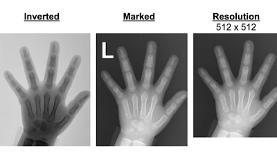 Computational 'stress tests' evaluated robustness of bone age #DL model to simulated real-world image variations doi.org/10.1148/ryai.2… @SamSantomartino @EBeheshtian @vishwa_parekh #PedsRad #MSKRad #ML