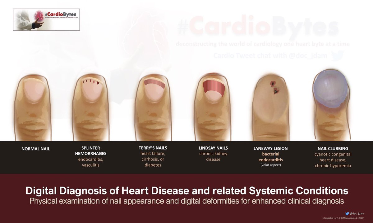 ori_114's tweet photo. Now I’m learning the difference of Lindsay’s nails vs Terry’s nails😉👍
Seems a bit similar but causes are different 🦋🫘
Informative picture throwback from @doc_jdam 👇 https://t.co/fli8pNN66g