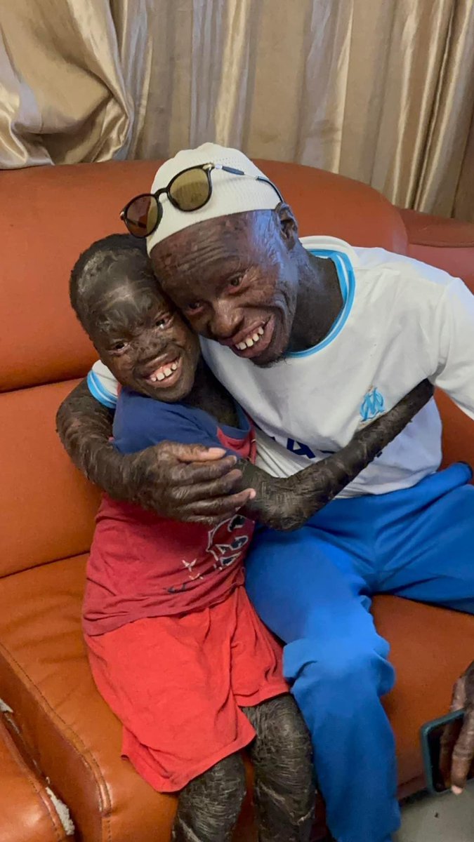 La famille ichtyose s'agrandit . Aujourd'hui nous avons reçu ...