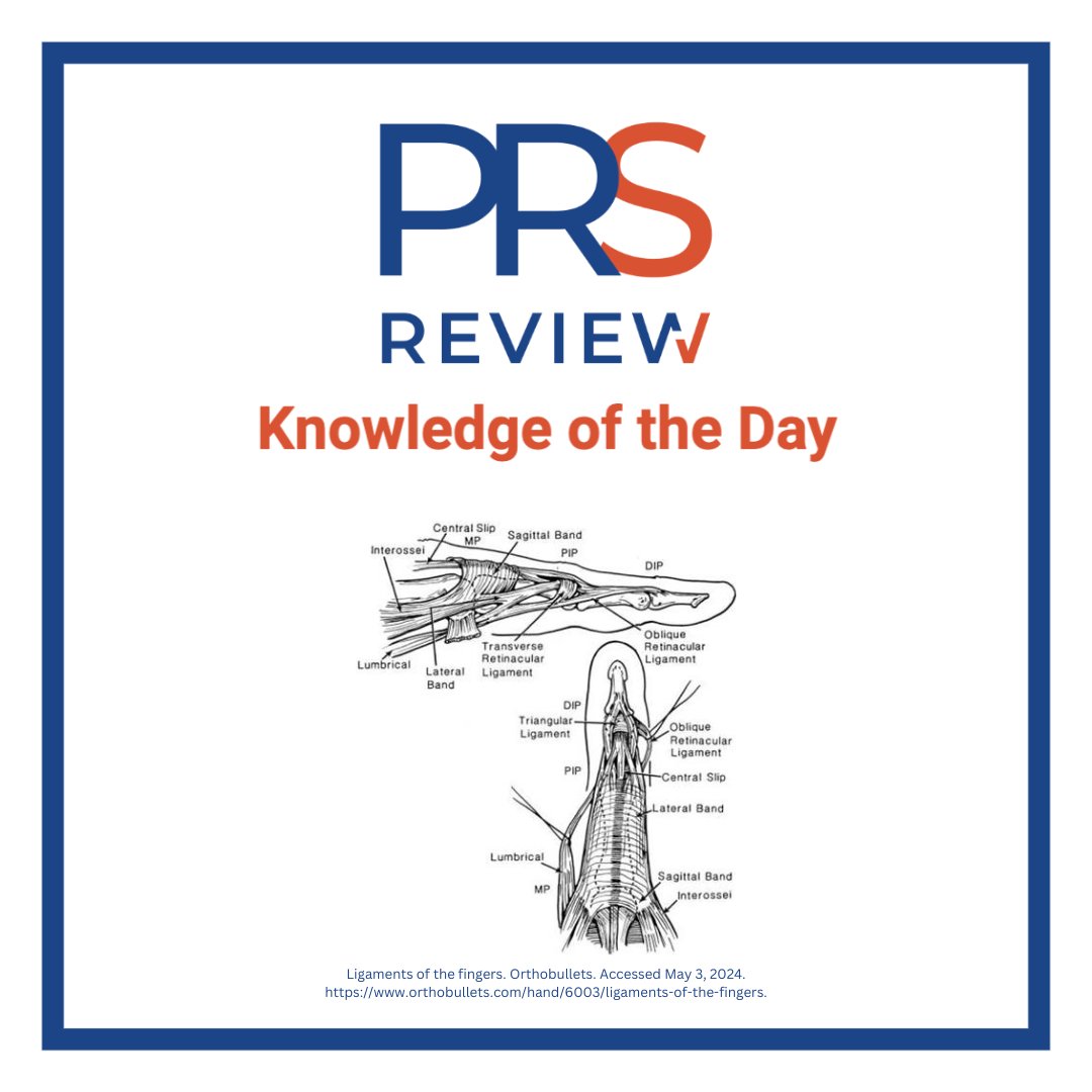 Oblique retinacular ligament reconstruction

#prsreview #ORLreconstruction #ligamentreconstruction #swanneckdeformity #handinjury #handsurgery #microsurgery #orthopedicsurgery #plasticsurgery #reconstructivesurgery #surgicaleducation #medicaleducation #meded #surgery