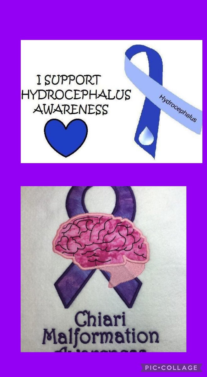 Living with hydrocephalus for over 50 years, then the CM diagnosis in 2020 makes you question a lot more than what you know. I want a cure, but there won't be one in my lifetime.

#hydrocephalus #chiarimalformation