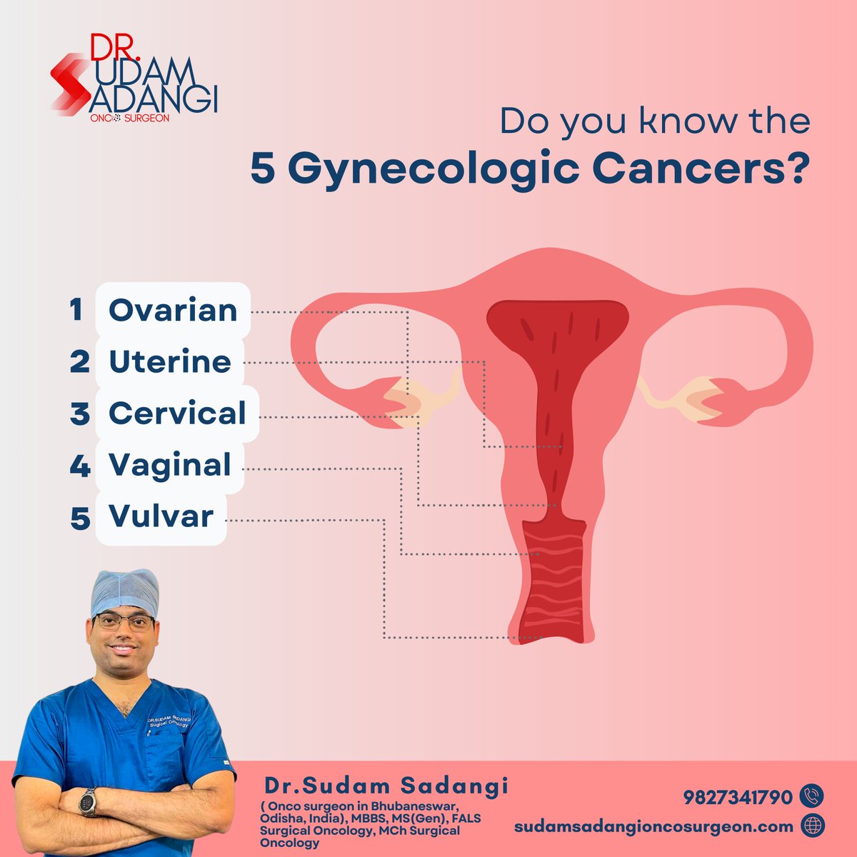 5 Gynecologic Cancers that are most commonly seen in Women. 
Ovarian
Uterine cancer
Cervical
Vaginal cancer
Vulvar cancer
#Gynecologiccancer #Ovariancancer #uterinecancer #cervicalcancer #vaginalcancer #vulvarcancer #DrSudamsadangi #Oncosurgeon #cancersurgeon #Odisha