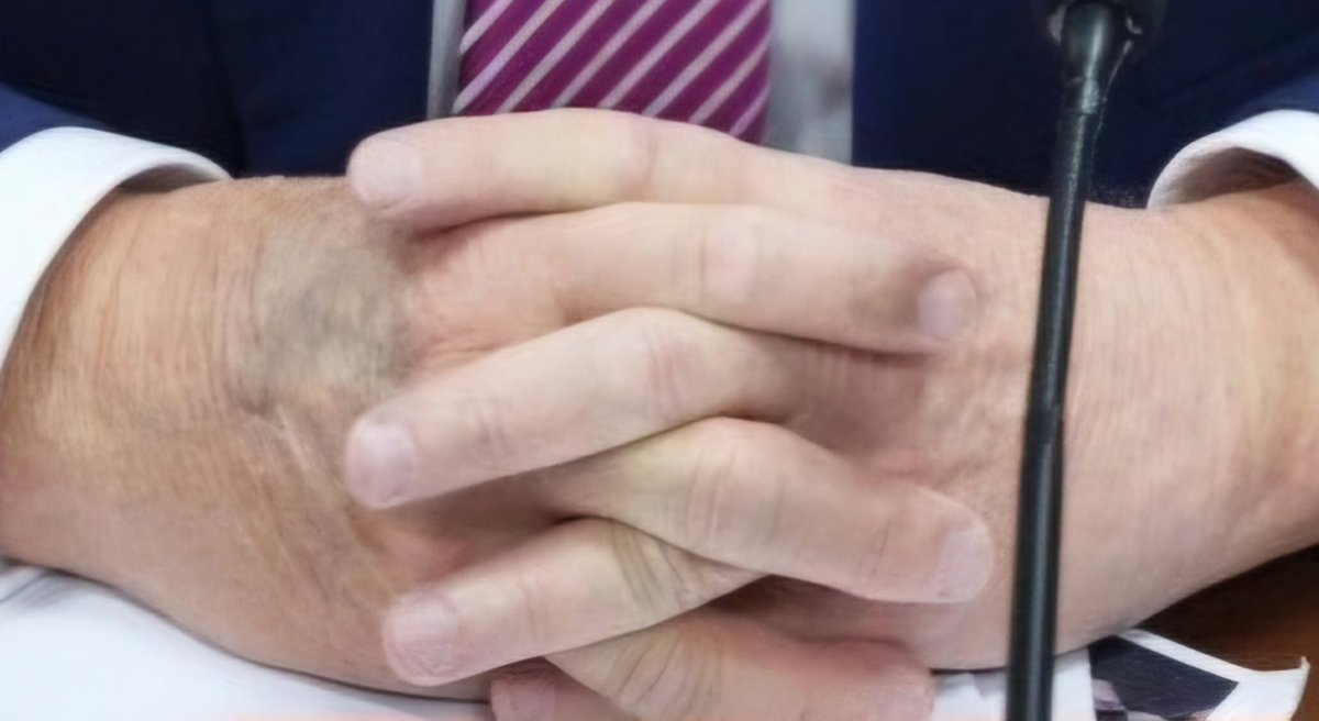 Trump always covers his right hand in court, I've noticed. Do you see what I see?