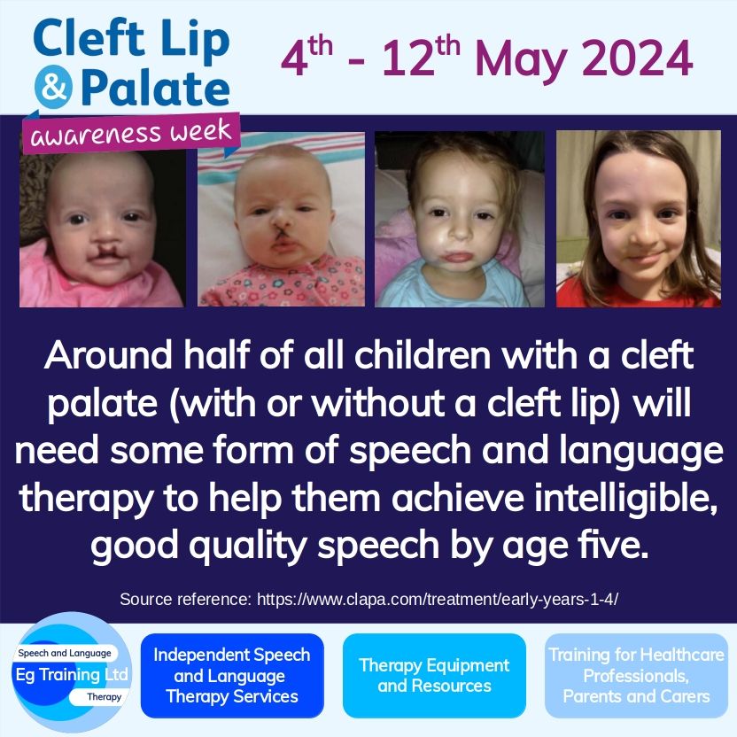 Speech and language therapy input for children born with a cleft palate is vital. Early intervention is key to developing the best speech outcomes, and to help prevent speech difficulties later on.

Learn more here: buff.ly/3QtGbB4

#cleftpalate #speechandlanguage #SLT