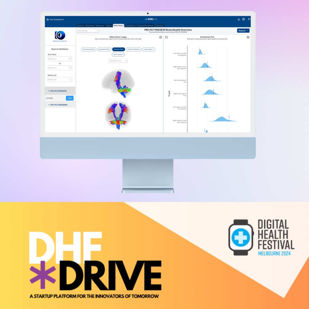 Excited to showcase our advanced neuroimaging system, MRI-me, at the 2024 Digital Health Festival! Join us at Pod 17 on the 7-8th of May, for a live demo and see how we’re pushing the boundaries of medical imaging. 🧠#DigitalHealthFestival #dhf24