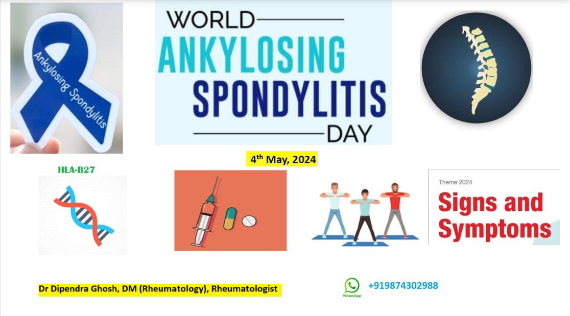 #ankylosingspondylitis