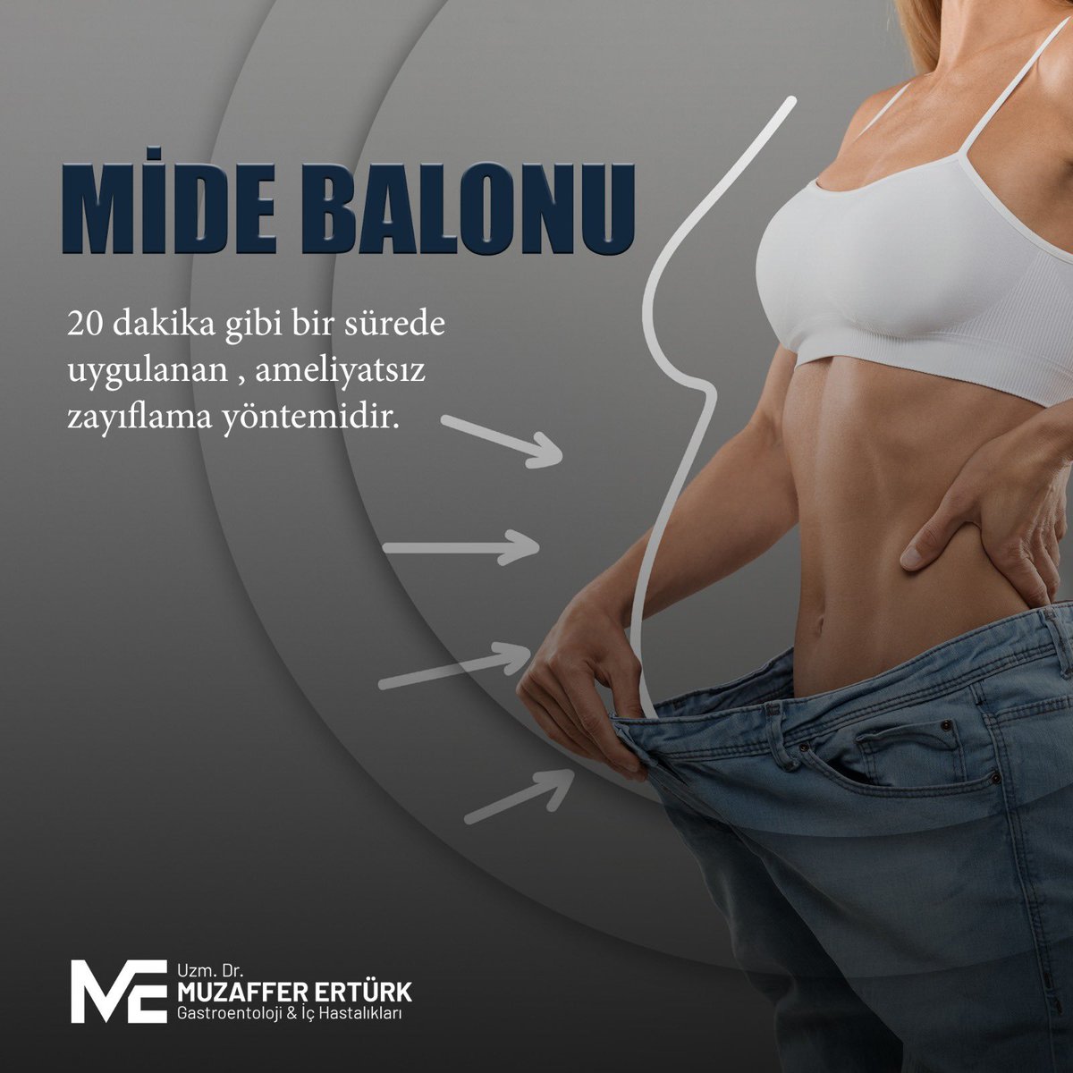 Mide Balonu Uygulaması ile ameliyatsız bir şekilde kilo vermek mümkün…

* Mide balonu uygulaması cerrahi bir işlem olmadığı için hastalar çok kısa süre hastanede kalmaktadır. 

#zayıflama #kiloverme #reels #instagram