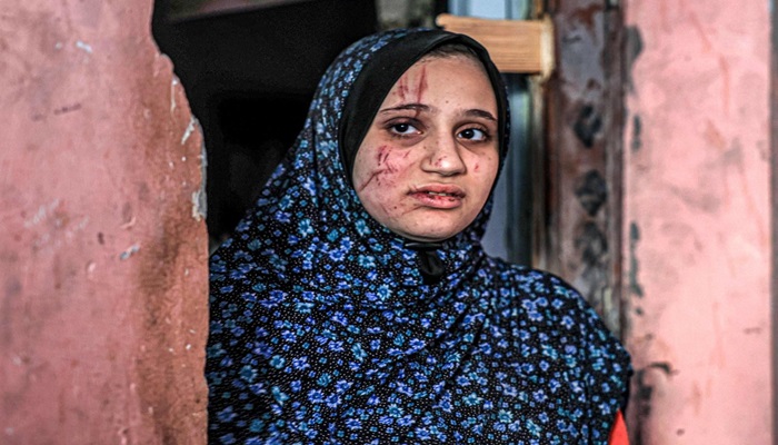 الأونروا: العدوان على غزة مستمر كحرب على النساء 