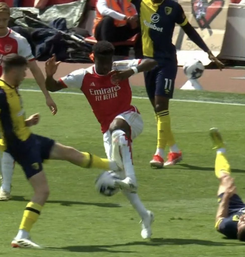 Rory_Talks_Ball's tweet image. “Why does Saka limp so much?”

Probably because these aren’t even given as fouls against him