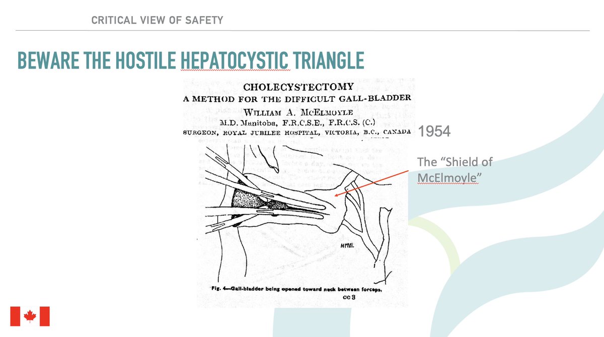 @mj_pucci @rbarbosa91 @EricKnauerMD @DissanaikeMD Found it: Lancet 1954. I think it was because of this paper that Strasberg termed the “Shield of McElmoyle”. Mike, you probably know best.