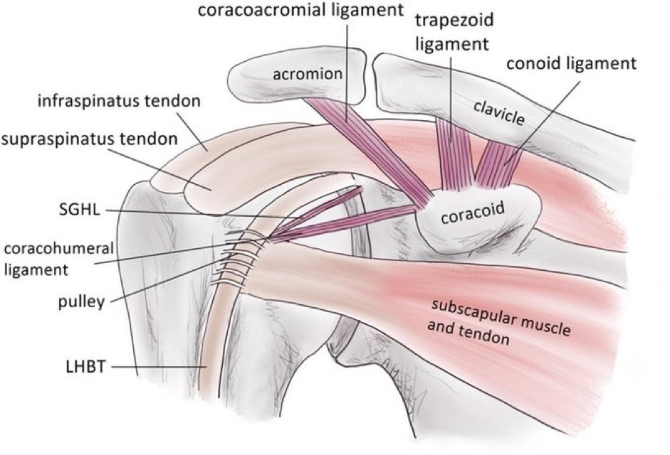 Simplified Shoulder Anatomy (Anterior View) LHBT: Long head of biceps tendon SGHL: Superior glenohumeral ligament #shoulder #anatomy semanticscholar.org/paper/Shoulder…