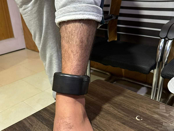 I JUST LOVE THIS NEW BHARAT!

Kupwara Police (J&K) have fitted GPS monitoring anklet to monitor 2 criminals out on Bail WITH Court Order. Abid Ali Bhat & Abdul Majeed Bhat, arrested under NDPS Act share the HONOURS!

Hell with FAKE Human Rights Activists. Criminals are Criminals!