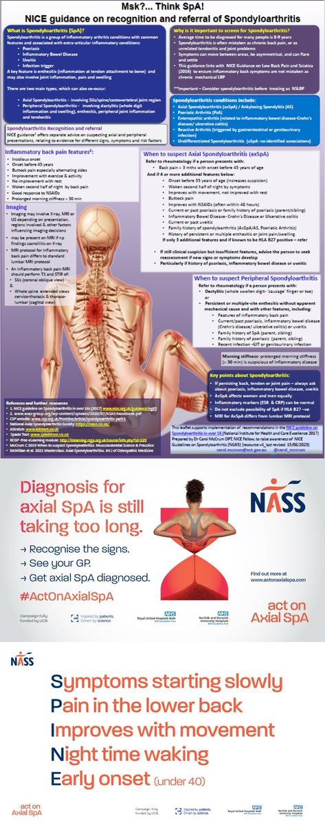 🧡Today is #worldasday National Axial Spondyloarthritis Society  

🤔Think #symptoms 👇

👊🏼Join the #actonaxialspa campaign and start the conversations 

👉🏼Check more resources on 

nass.co.uk

#physio #physiotherapy #physiotherapie #physiotherapist #physiostudent