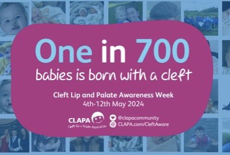 One in 700 babies is born with a cleft. We’re supporting Cleft Lip and Palate Awareness Week ❤️❤️❤️ @CLAPACOMMUNITY
