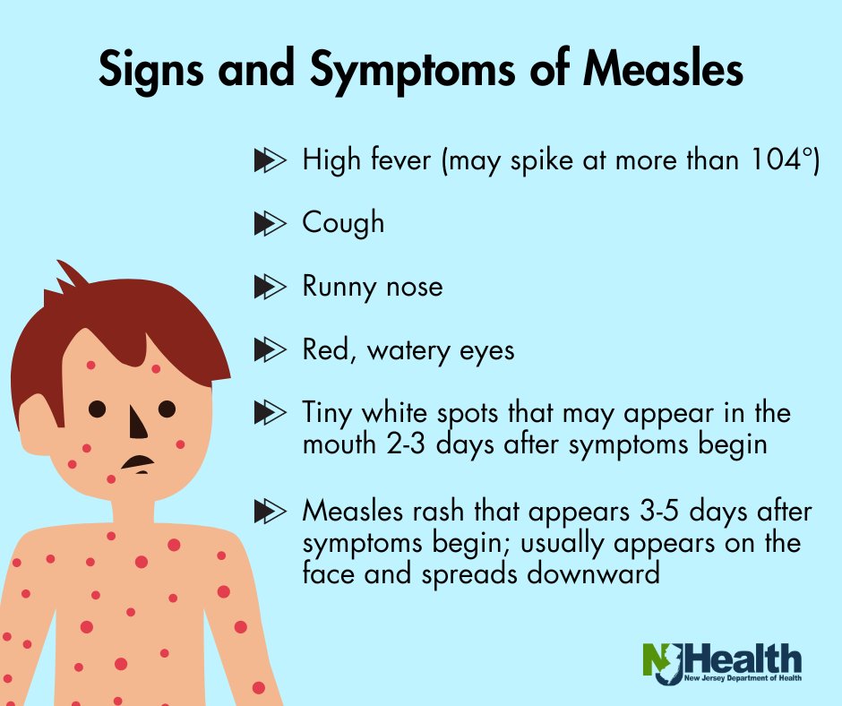 Measles has many symptoms, including high fever, cough, runny nose, red and watery eyes, tiny white spots in the mouth and measles rash. If you think you or your loved one has measles, contact your health care provider immediately. Learn more: cdc.gov/measles/index.… #HealthierNJ