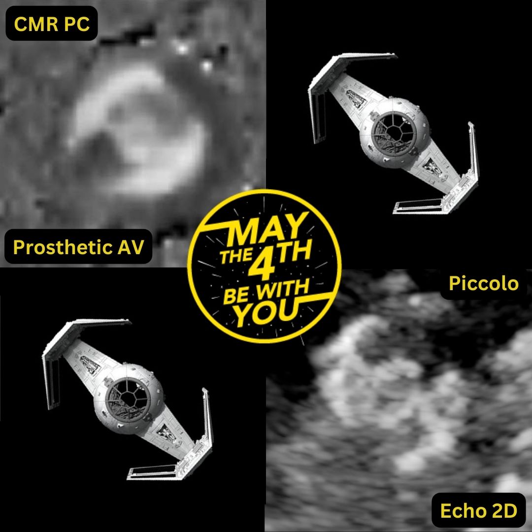 🚀Happy May the 4th! 🫀🧲 #WhyCMR PC of a prosthetic aortic valve 🫀 #echofirst of Piccolo 🚀Both resemble Darth Vader's TIE fighter 🫀CV Imaging is truly out this world! @TLHM_MD @Doc_Tiger @vass_vassiliou @AlsaiedTarek @FredWuMD @DrJenniferCo_Vu @purviparwani