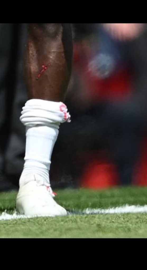 A petition for better referees. And a petition for footballers to stop wearing non existent shin pads 🙏
