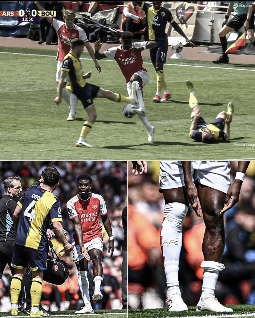 jerryarvino's tweet image. "Fans Arsenal mah ngeluh wasit melulu"

Ya coba aja bayangin, pemain andalan tim lo ditekel keras sampe tembus decker dan berdarah gini tapi lawan tetep gak dapet kartu merah. And this is not the first time.

Rasanya pengen protes gak? 🤣