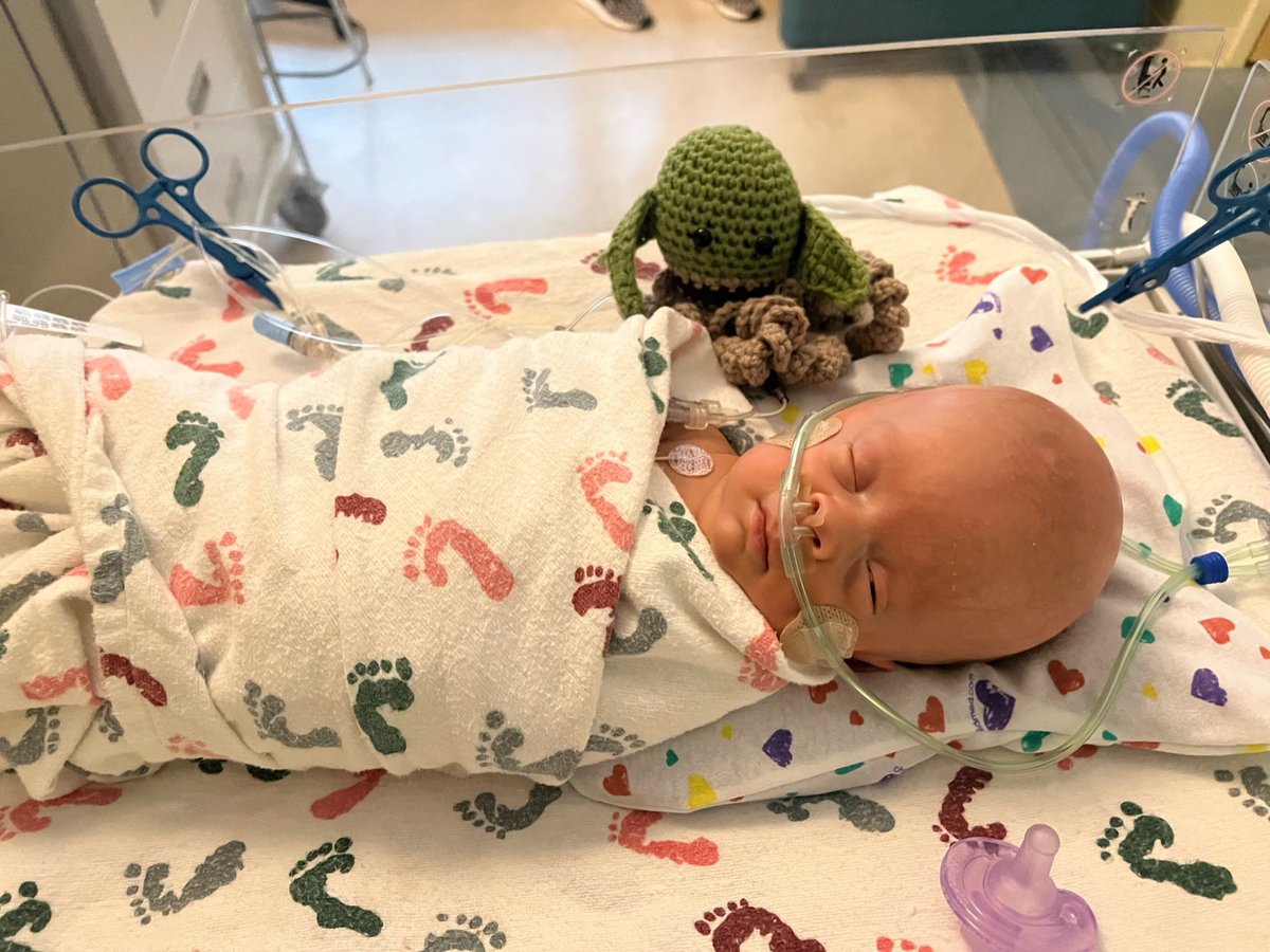 In honor of #maythe4thbewithyou here is Cooper with his Yoda octopus. #nicu #nicusupport #nicunurse #nicumom #nicubaby #nicudad #nicusocialworker