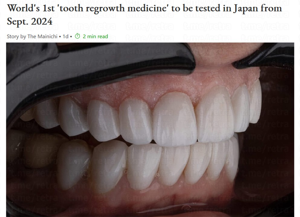 В прошлом году мы писали про первый в мире препарат для выращивания новых зубов. И теперь в Японии готовятся тестировать его на людях уже с сентября В рамках испытания, лекарство будет вводиться внутривенно испытуемым возрасте от 30 до 64 лет. У субъектов должен отсутствовать