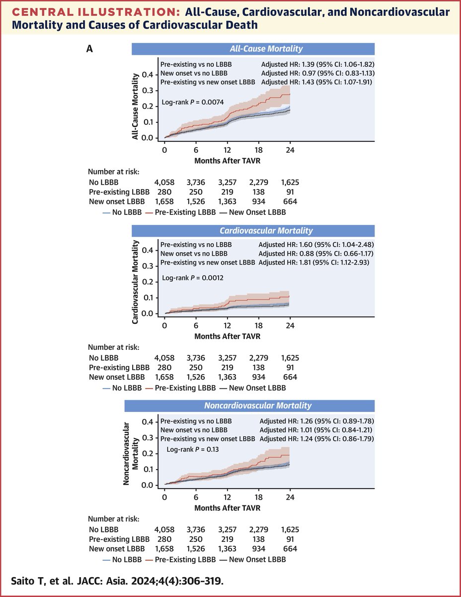 In #TAVR patients, pre-existing #LBBB was independently associated with poor clinical outcomes, reflecting an increased risk of cardiovascular mortality after the procedure. bit.ly/3UnMgQV

#JACCAsia #cvVHD @Yusukeewatanabe @masahiko_asami