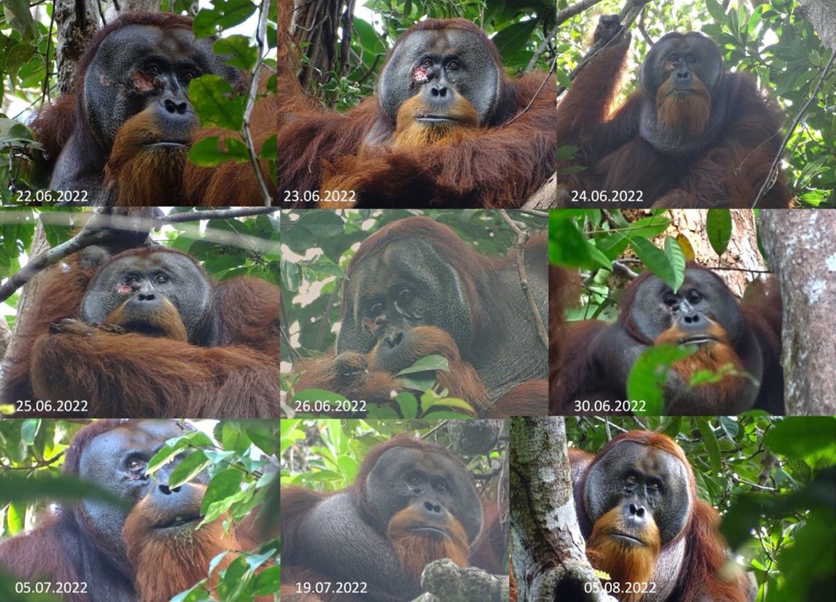 🦧 Endonezya’da yüzünden yaralanan bir orangutan kendini şifalı bir bitkinin yapraklarıyla iyileştirdi. 

Endonezya'da yüzünden yaralanan vahşi bir erkek orangutan, şifalı olduğu bilinen Sarı Kök adlı asma bitkisinin (Fibraurea tinctoria) yapraklarını koparıp, çiğnedikten sonra…