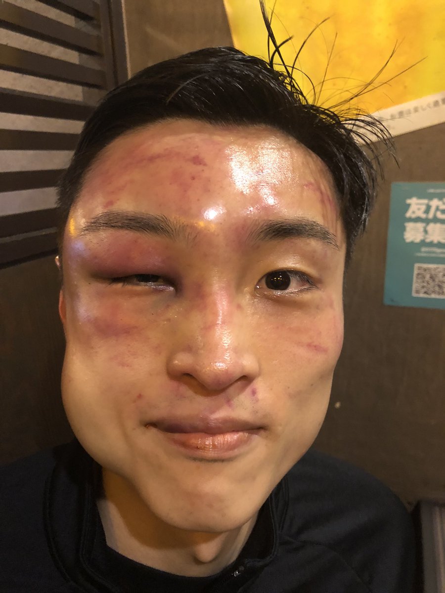 We Don’t Play Boxing. This is what it took for Ryosuke Nishida to become bantamweight world champion 😮‍💨 📸 @mjaltamura #RodriguezNishida